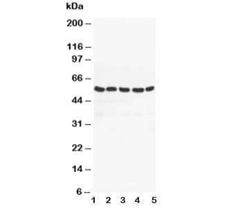 PPARG / PPAR Gamma Antibody (aa76-93)