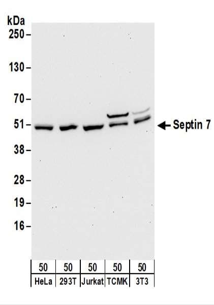 IHC-plus™ Polyclonal Rabbit anti-Human SEPT7 / Septin 7 Antibody (aa75-125, IHC, WB)