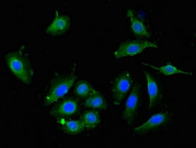 Polyclonal Rabbit anti-Human DPYSL4 / CRMP3 Antibody (IHC, IF)