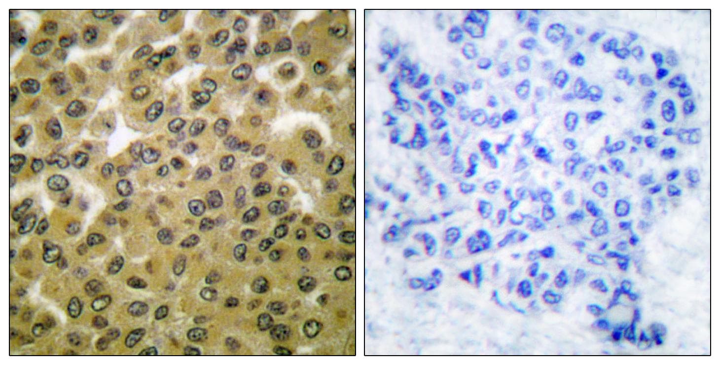 GSK3A / GSK3 Alpha Antibody (phospho-Tyr279/216)