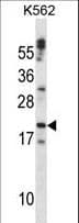 CTF1 / Cardiotrophin-1 Antibody (aa166-194)