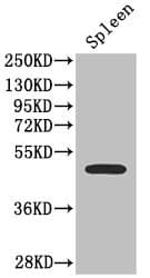 Polyclonal Rabbit anti-Human SSTR2 Antibody (IHC, IF, WB)