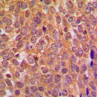 Polyclonal Rabbit anti-Human AKT1 + AKT2 + AKT3 Antibody (Internal, IHC, WB)