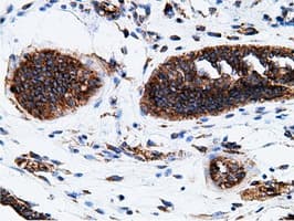 KHK / Ketohexokinase Antibody (clone OTI3D1)