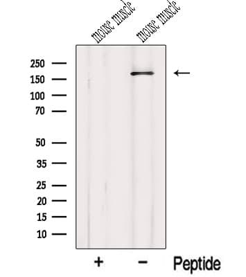 MYOM1 / Myomesin 1 Antibody