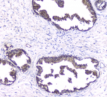 PRKCB / PKC-Beta Antibody