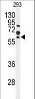 Polyclonal Rabbit anti-Human FZD4 / Frizzled 4 Antibody (aa495-522, WB)