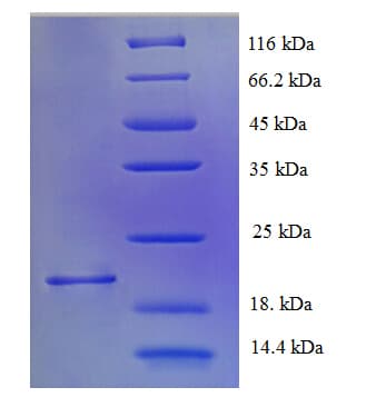 Rat CHRM1 / M1 Protein (Recombinant His)