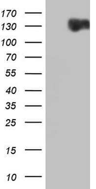 Monoclonal Mouse anti-Human RET Antibody (clone OTI2G6, aa713-1017, WB)