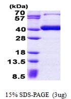 Human B3GAT3 Protein (Recombinant His)