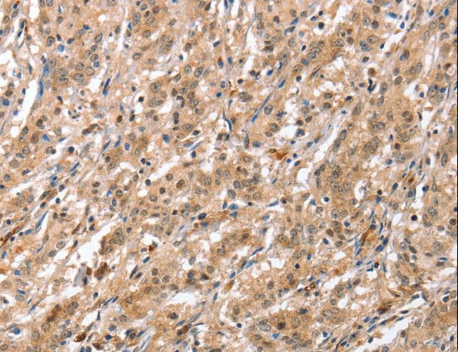 APG12 / ATG12 Antibody