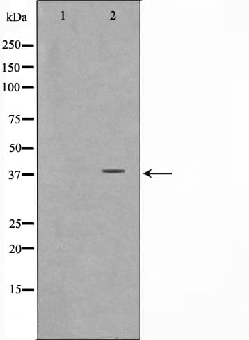 ARMCX3 Antibody