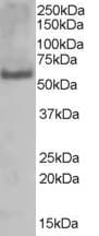 IHC-plus™ PUF60 Antibody (aa530-542)