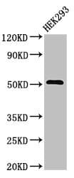 Polyclonal Rabbit anti-Human TNFRSF10A / DR4 Antibody (IHC, IF, WB)