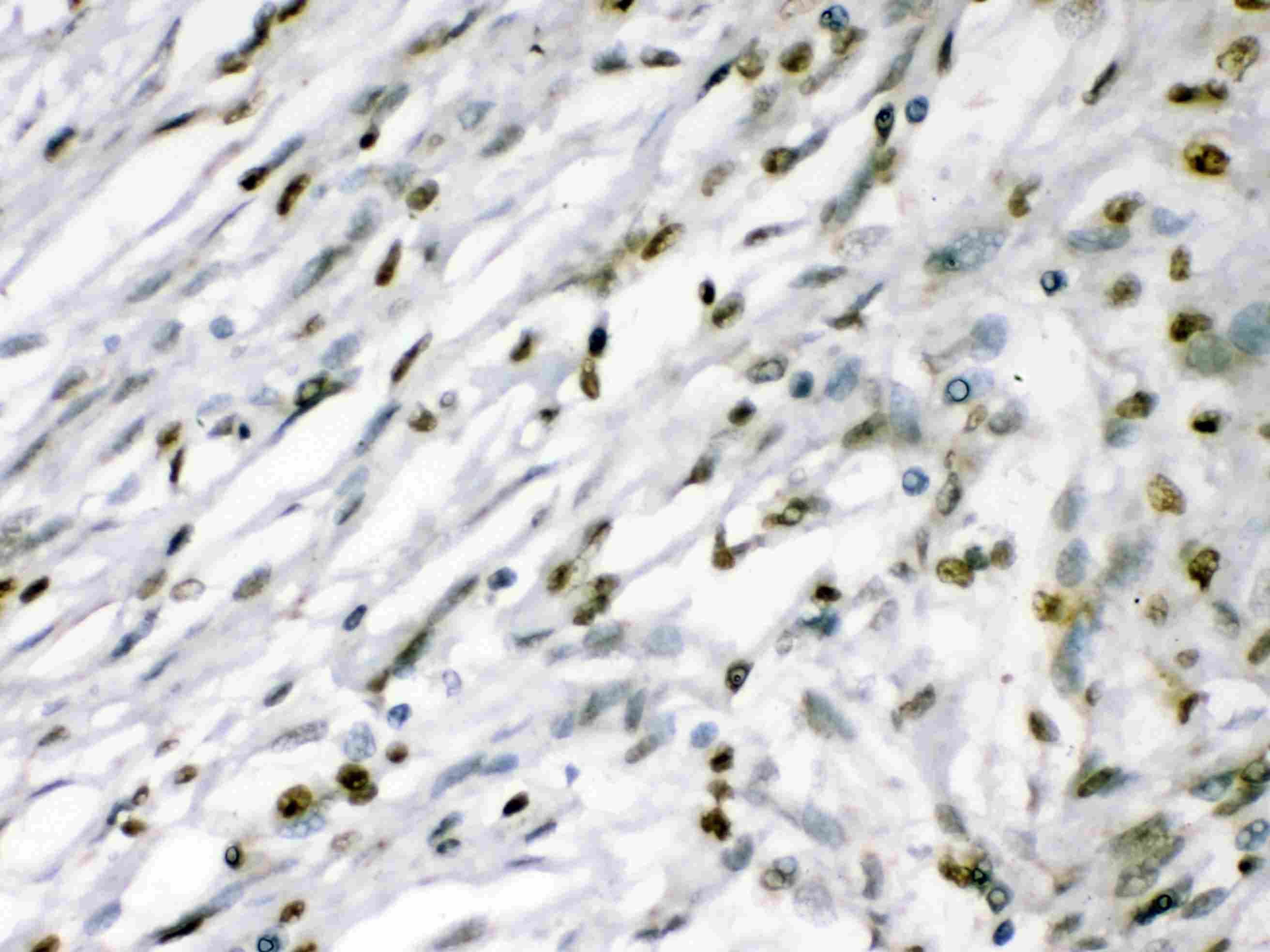 MEF2A / MEF2 Antibody