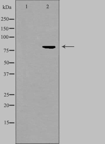 CARF / ALS2CR8 Antibody