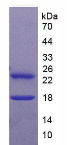 Mouse IL27 Protein (Recombinant His)