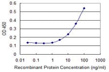 ZNF18 Antibody (clone 2A4)