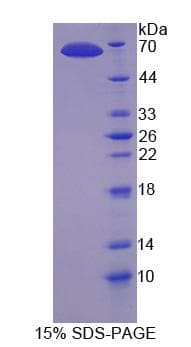 Human DNHD1 Protein (Recombinant)