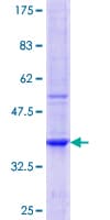 Human TPTE Protein (Recombinant GST, N-terminus)