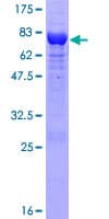 Human PSMD5 Protein (Recombinant GST)