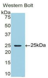 AMBP Antibody (aa22-203)