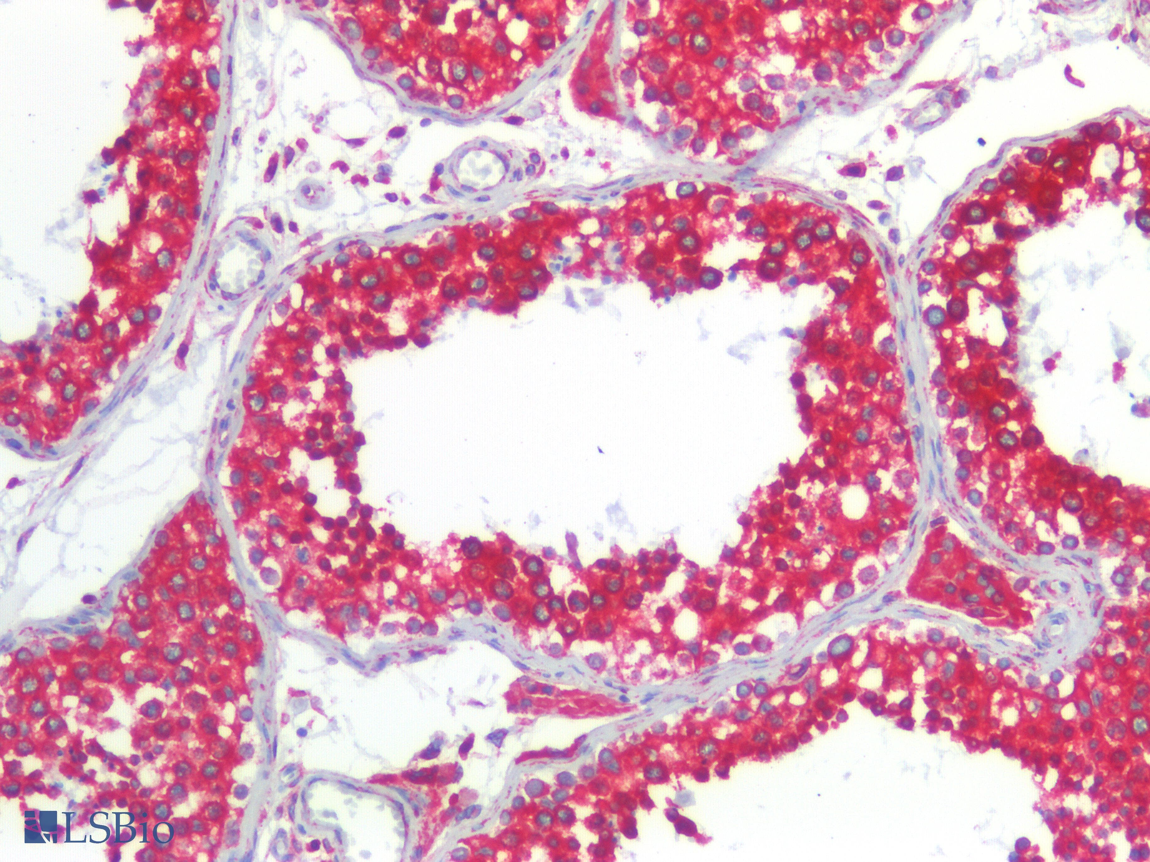 PathPlus™ CANX / Calnexin Antibody