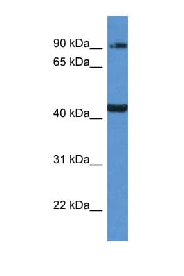 AMACR / P504S Antibody (aa286-335)