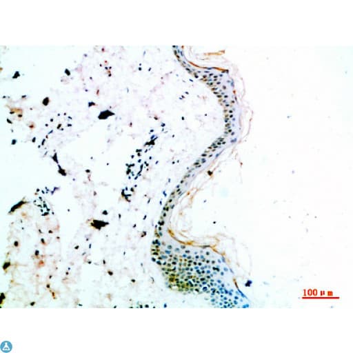 Polyclonal Rabbit anti-Human COL14A1 / Collagen XIV Antibody (IHC)