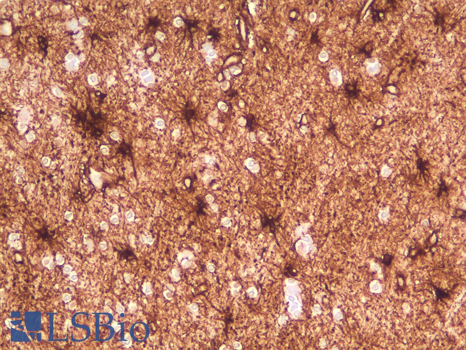PathPlus™ GFAP Antibody (clone rASTRO/789)