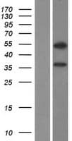 ZNF645 Protein (Over-Expression Lysate Myc-DDK (Flag))