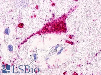 PathPlus™ GPRC5D Antibody (N-Terminus)