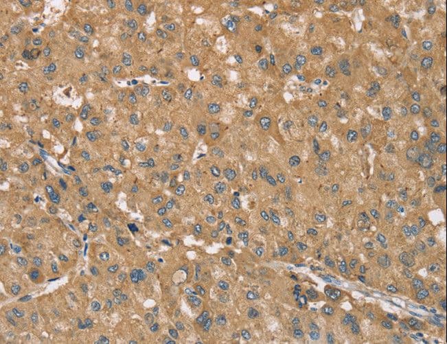 RNF148 Antibody