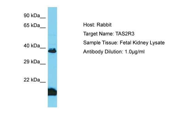 TAS2R3 Antibody (aa129-178)