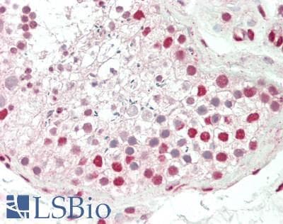 IHC-plus™ RECQ1 / RECQL Antibody (aa1-50)