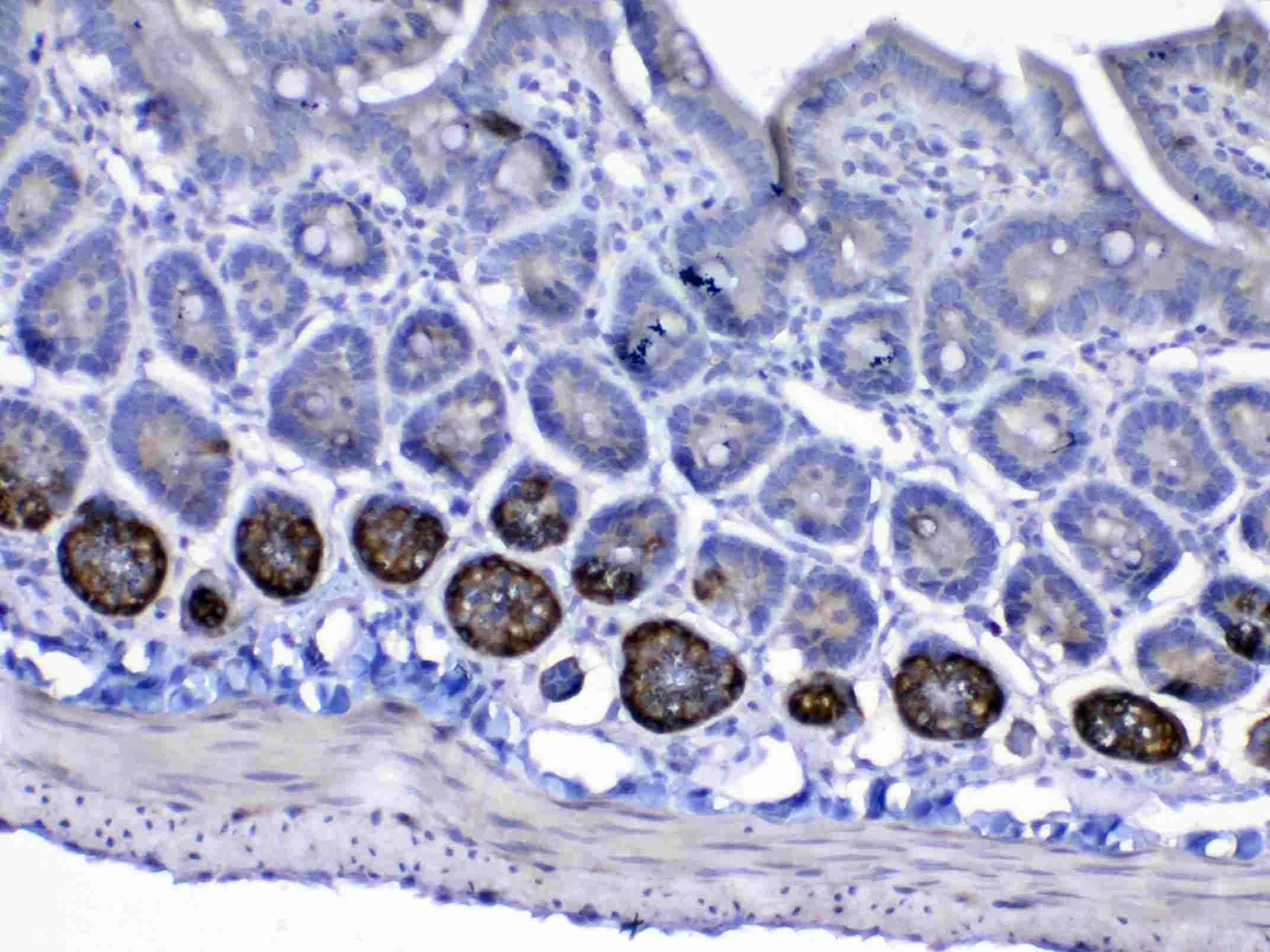 IGF1R / IGF1 Receptor Antibody