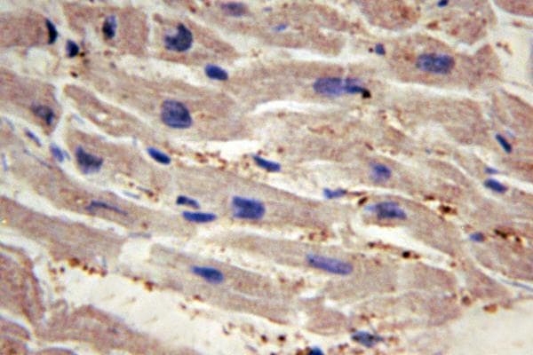 YAP / YAP1 Antibody (His122)
