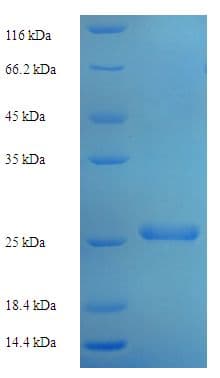 Human TMEM98 Protein (Recombinant His)