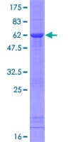 Human EIF6 Protein (Recombinant GST)