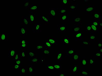 HIST1H1C Antibody