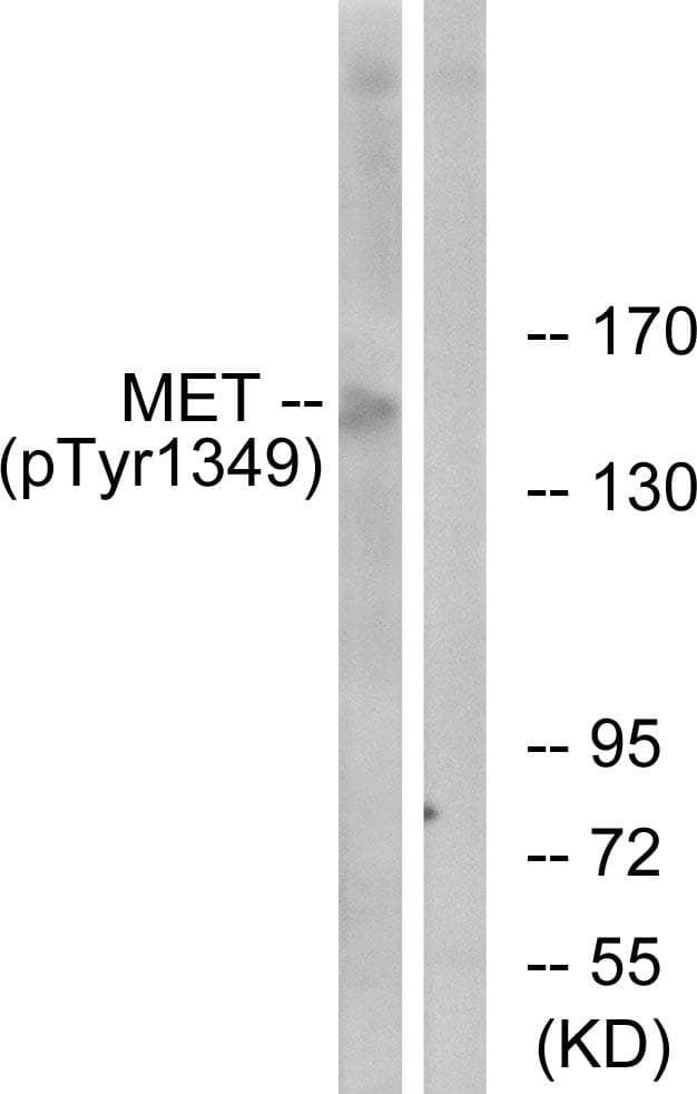 Polyclonal Rabbit anti-Human c-Met Antibody (phospho-Tyr1349, WB)