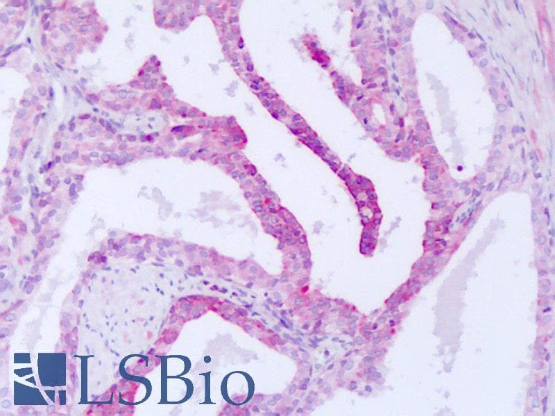 STK33 Antibody (aa34-83)