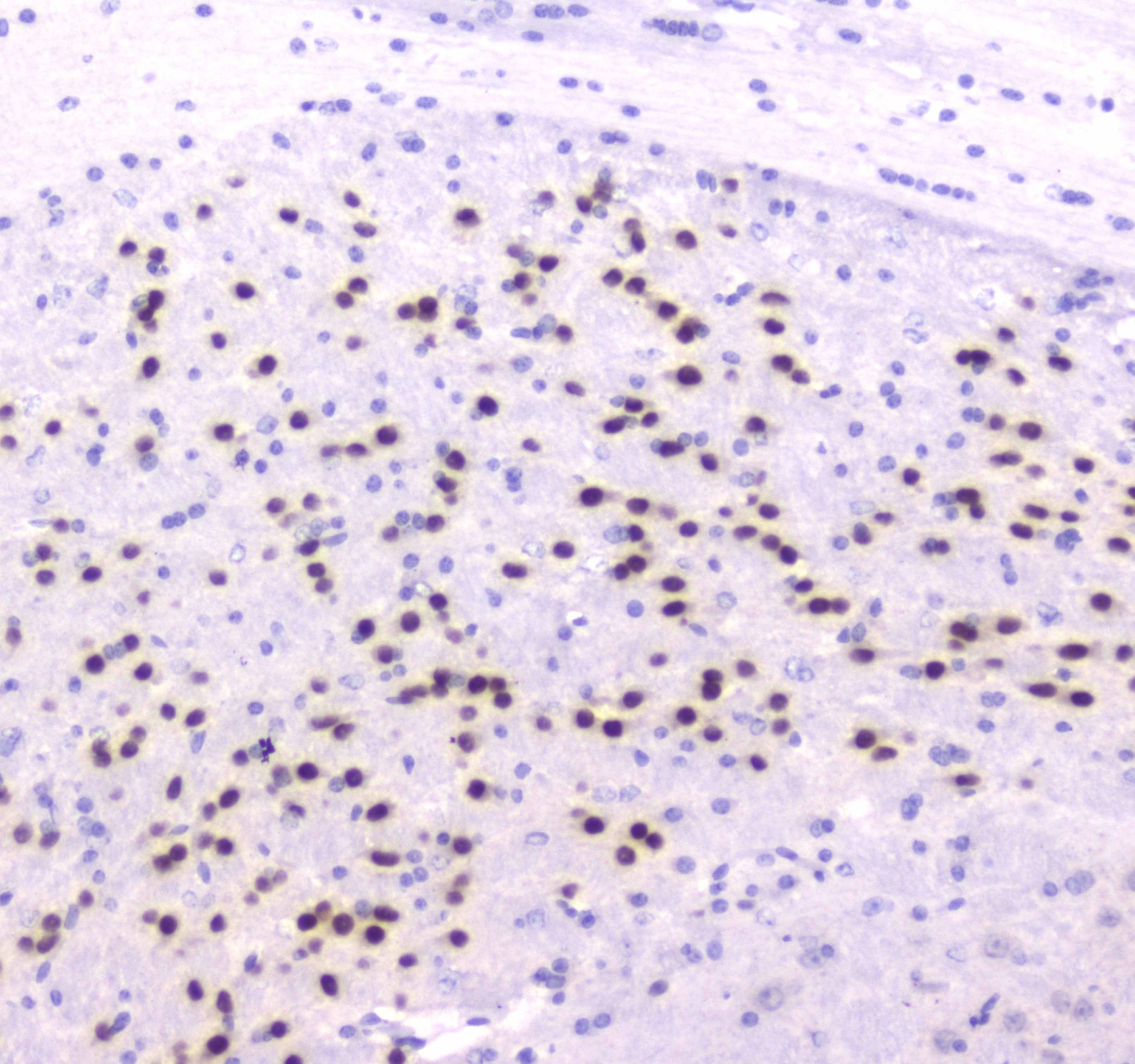 ESRRG / ERR Gamma Antibody