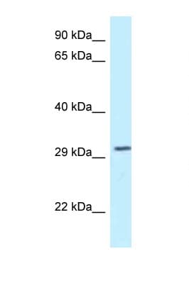 TOLLIP Antibody (N-Terminus)