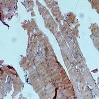 PRKAA1 / AMPK Alpha 1 Antibody