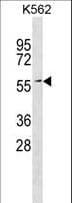 ERF / PE2 Antibody (aa485-514)