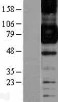 FCGR1A / CD64 Protein (Over-Expression Lysate Myc-DDK (Flag))