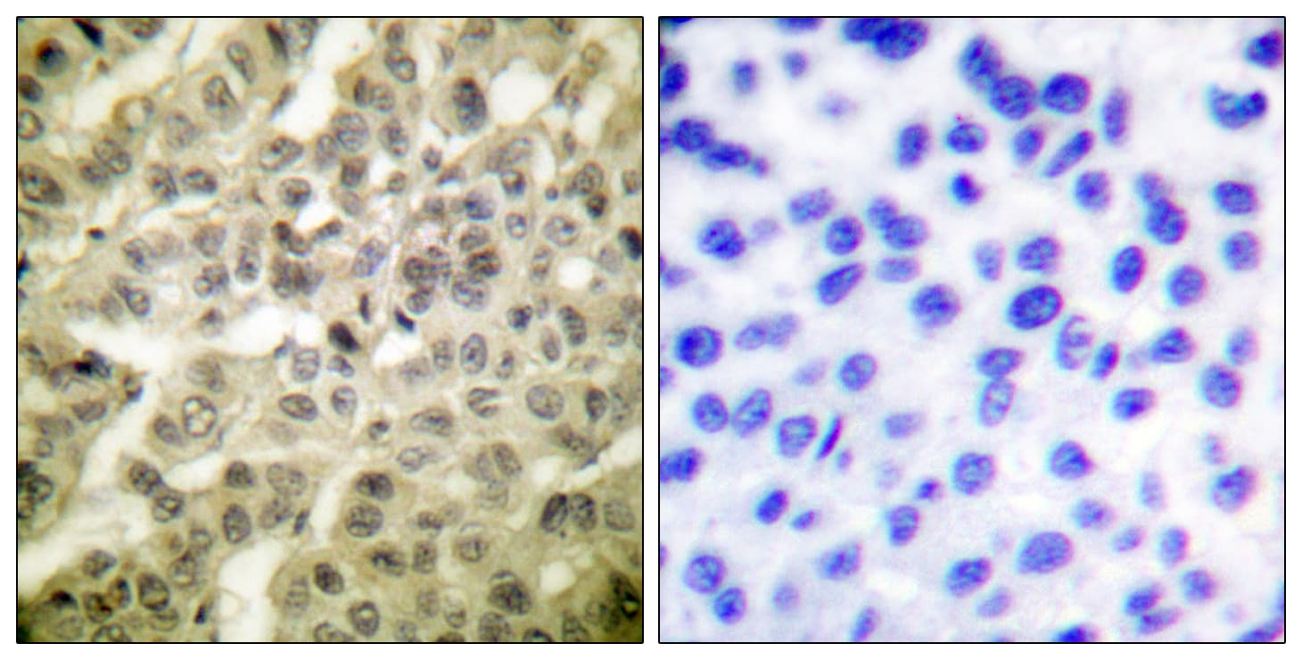 AKT1 + AKT2 + AKT3 Antibody (phospho-Thr308)