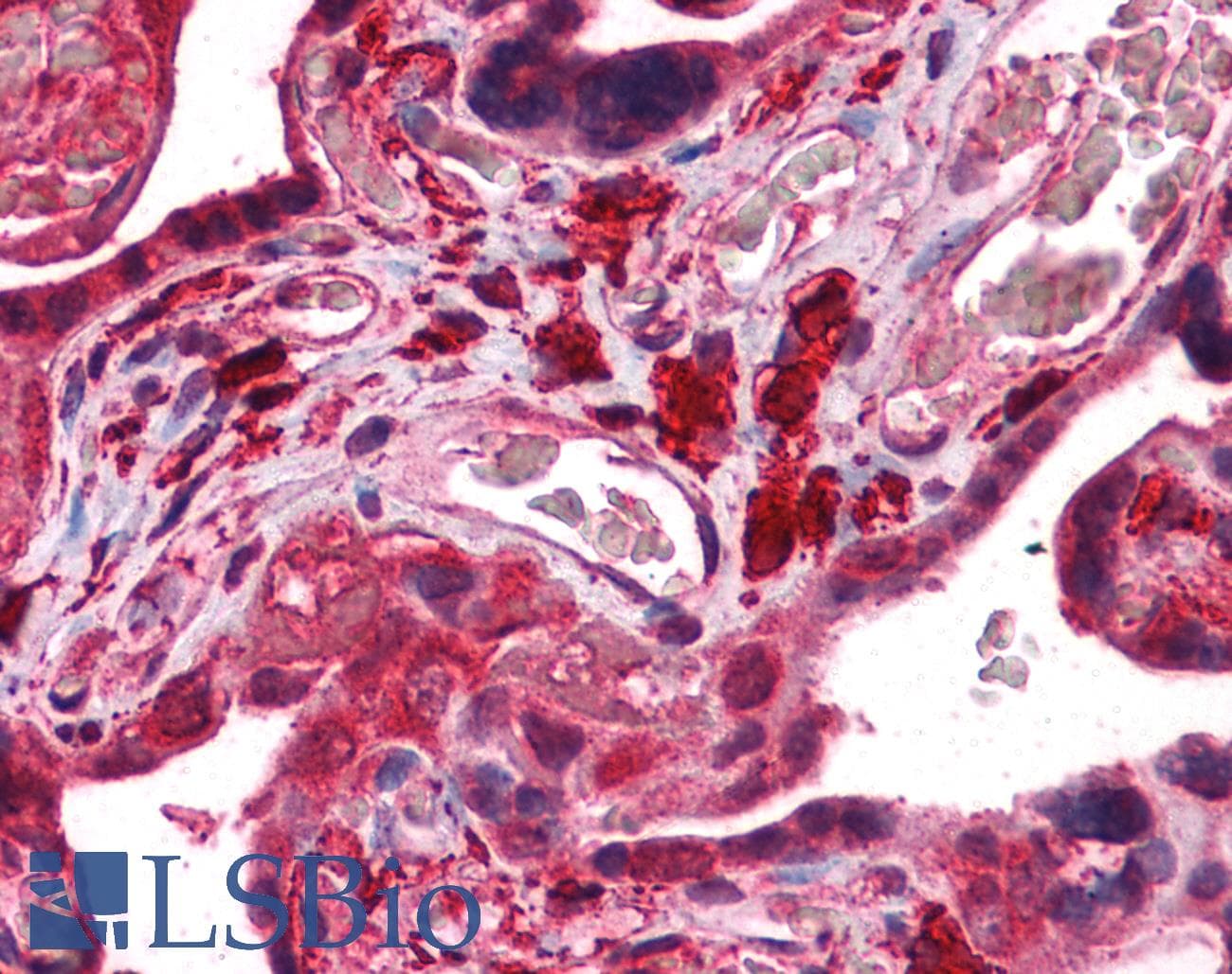 IHC-plus™ FKTN / Fukutin Antibody