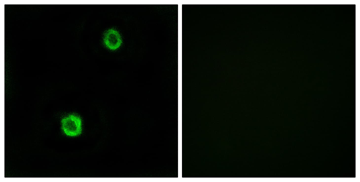 IHC-plus™ CST1 / Cystatin SN Antibody (aa31-80)
